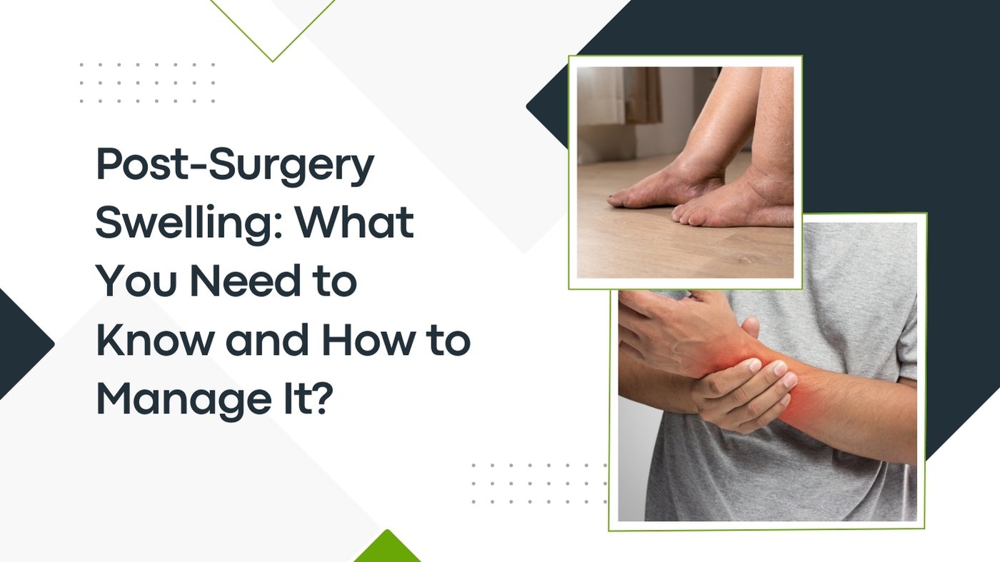 Post-Surgery Swelling: What You Need To Know And How To Manage It?