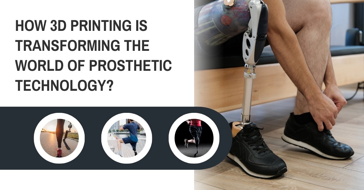 How 3D Printing Is Transforming The World Of Prosthetic Technology?